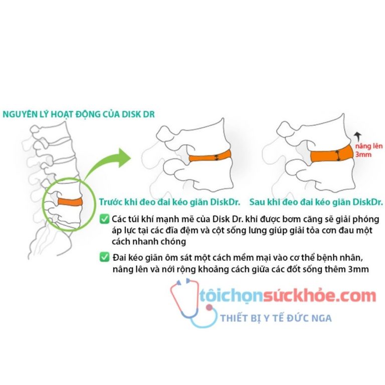 nguyên lý hoạt động DISK DR